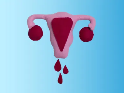 Abnormal-uterine-bleeding