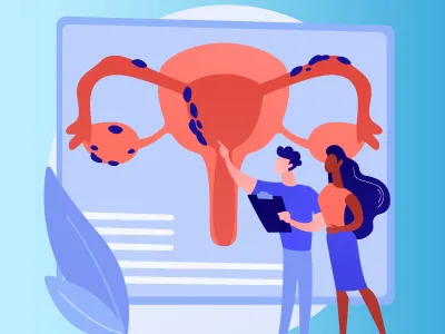 diagnosis of endometriosis