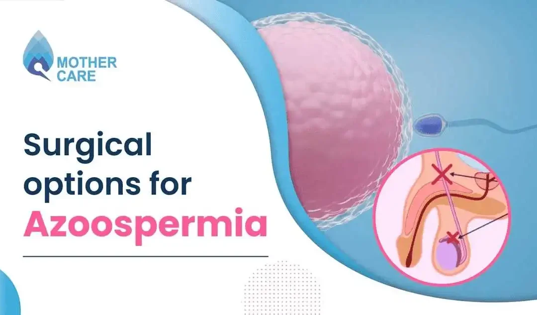 Understanding Surgical Solutions for Azoospermia