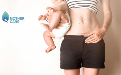 Does a High-Risk Pregnancy Mean a C-Section? Myths vs. Facts