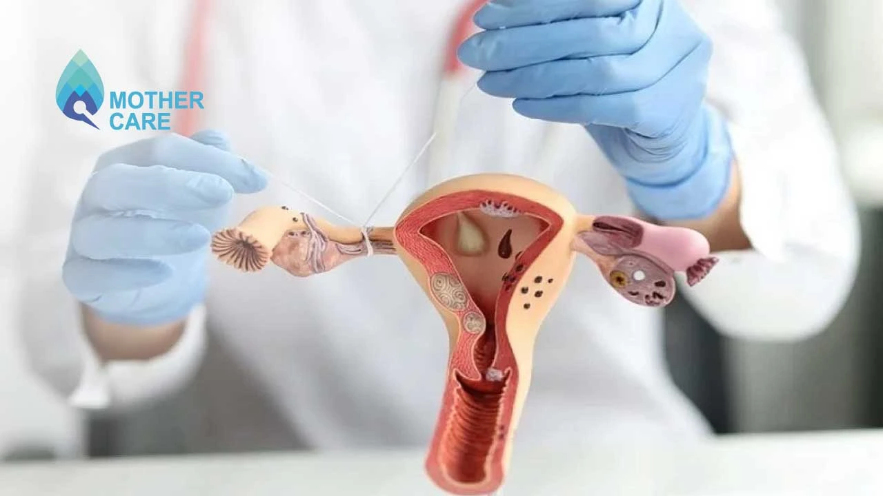 Why Are Fallopian Tubes Blocked? Why Are Fallopian Tubes Blocked?
