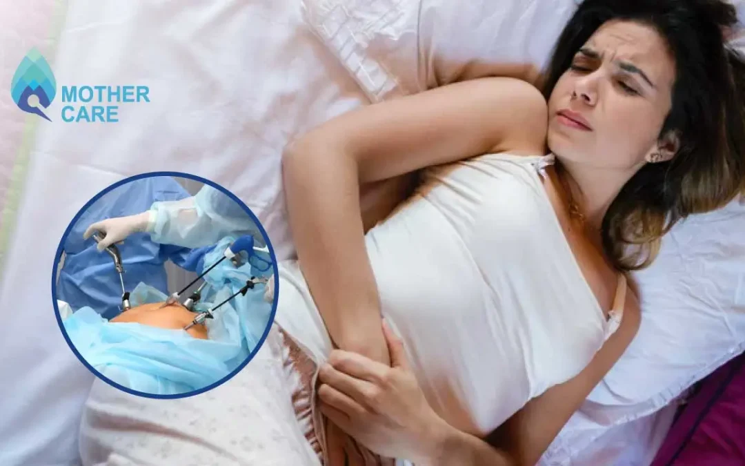 How To Sleep After Laparoscopic Surgery?