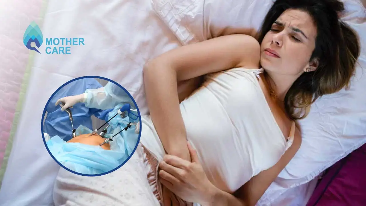 How To Sleep After Laparoscopic Surgery? How To Sleep After Laparoscopic Surgery?