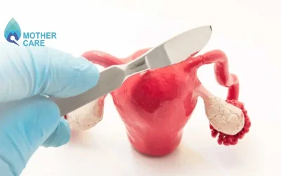 What to Expect After Fallopian Tube Removal?