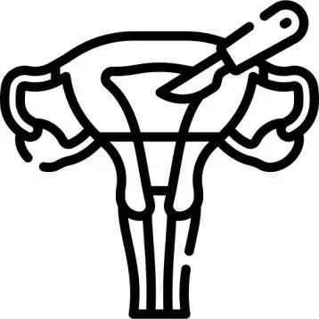 Hysterectomy